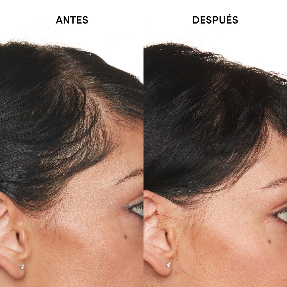 SCALP SERUM (SUERO CAPILAR)